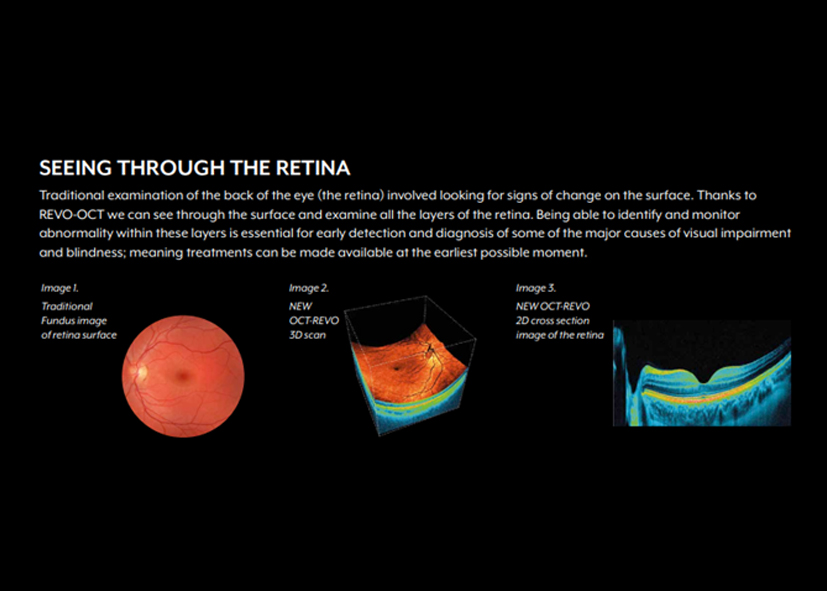 OCT scan Southport - Silver & Rose